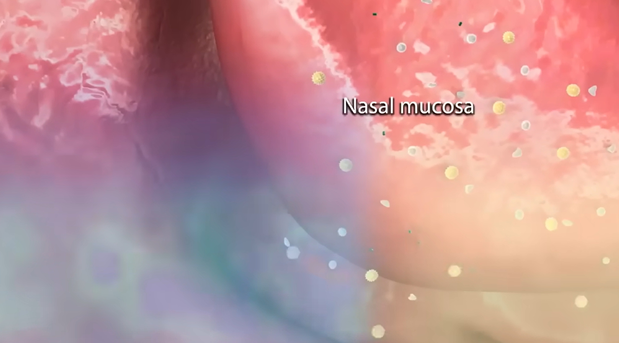 콧물이 계속 나는 이유