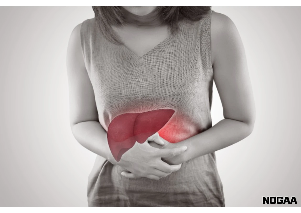 간경화 복수환자가 피해야 할 음식