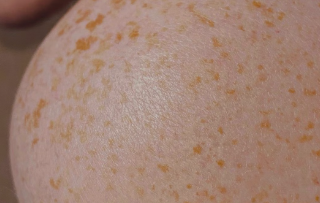 미오이노시톨 피부 건강 효능