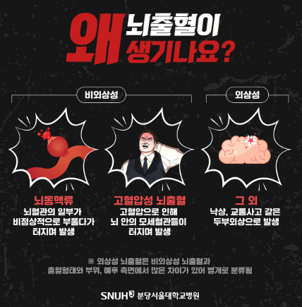 뇌출혈 전조증상 원인 5가지 골든타임 대처법 초기증상 예방법 총정리 1