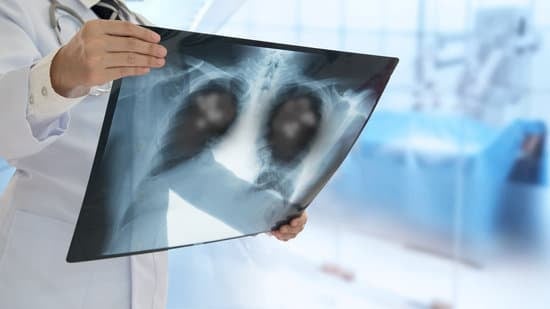 폐렴 (Pneumonia): 원인, 증상, 진단 및 치료