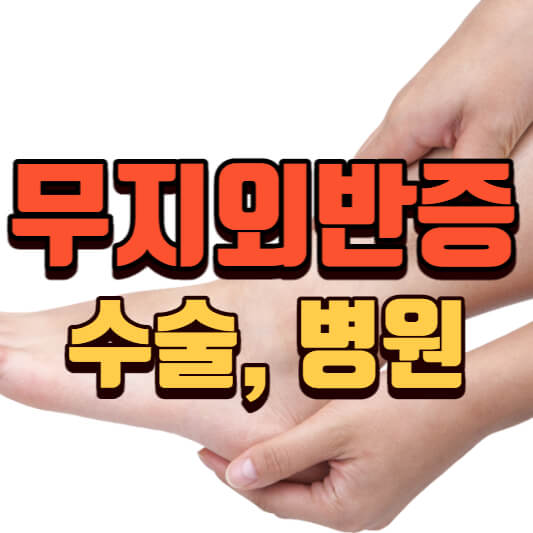 무지외반증수술-병원
