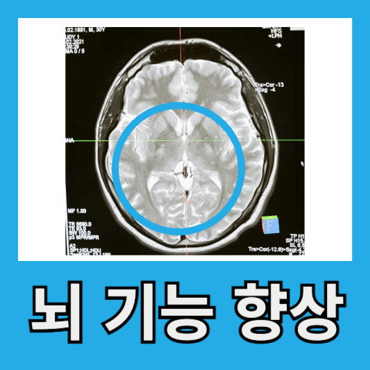 뇌 기능 향상