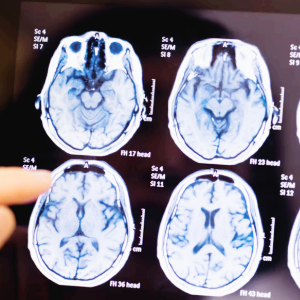 AI 의료 관련주 대장주 테마주 TOP5