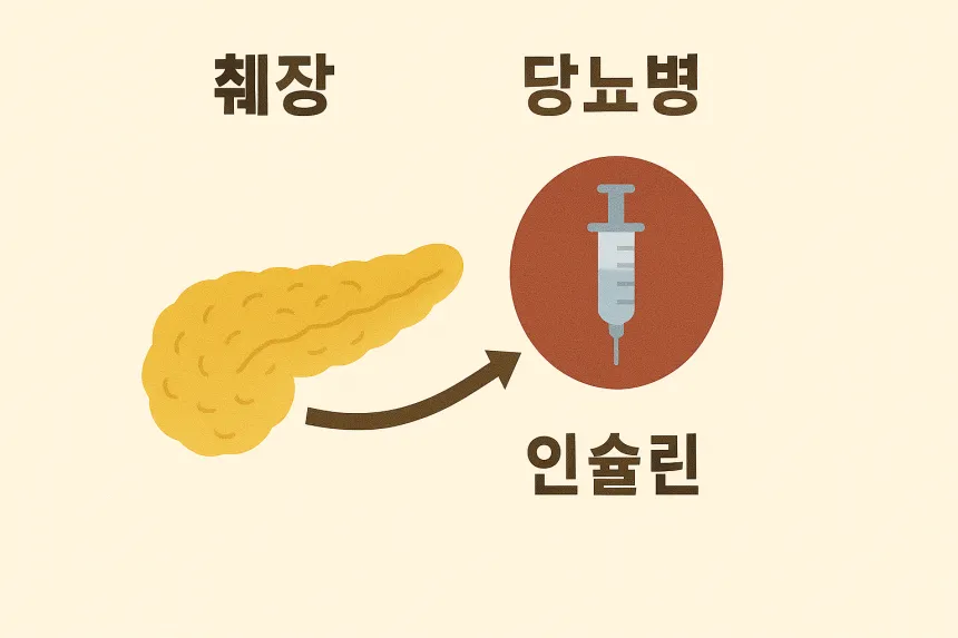 췌장암 초기증상