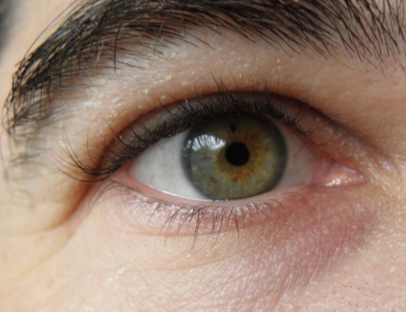 다크서클없애는법