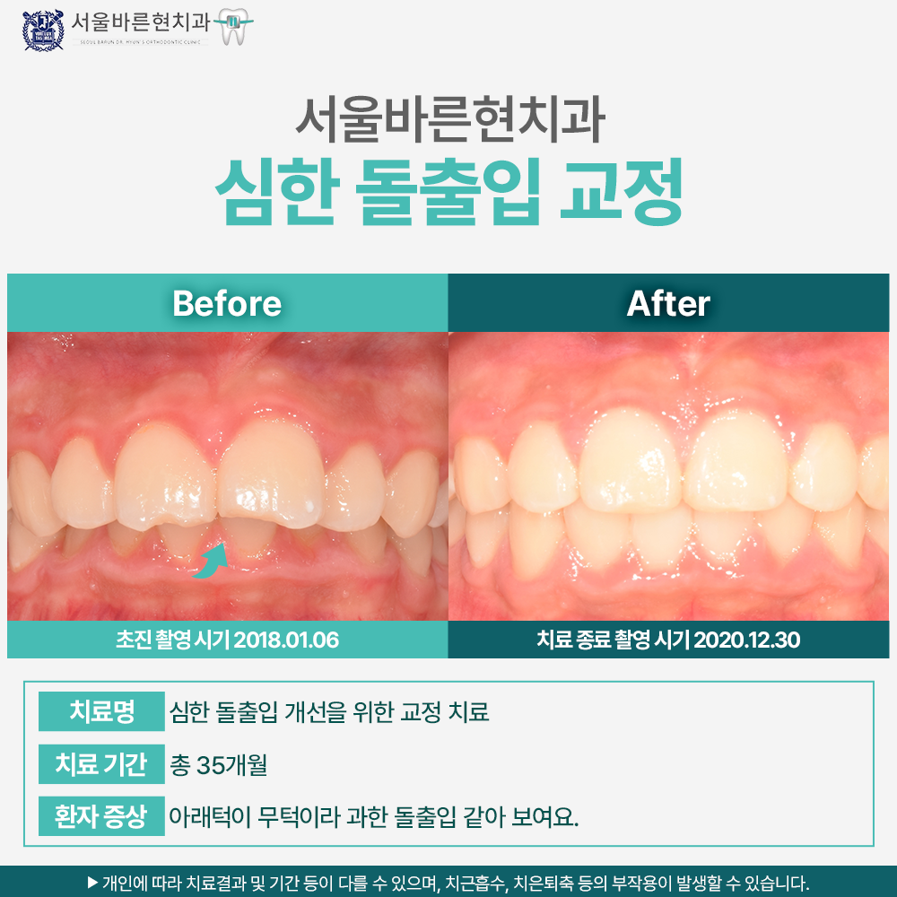 해운대 교정치과