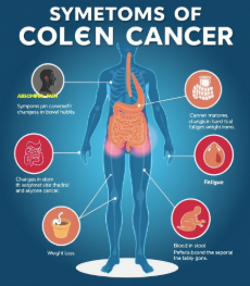 대장암 증상과 치료법