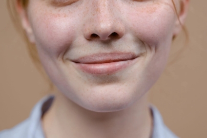 팔자주름-없애는-방법