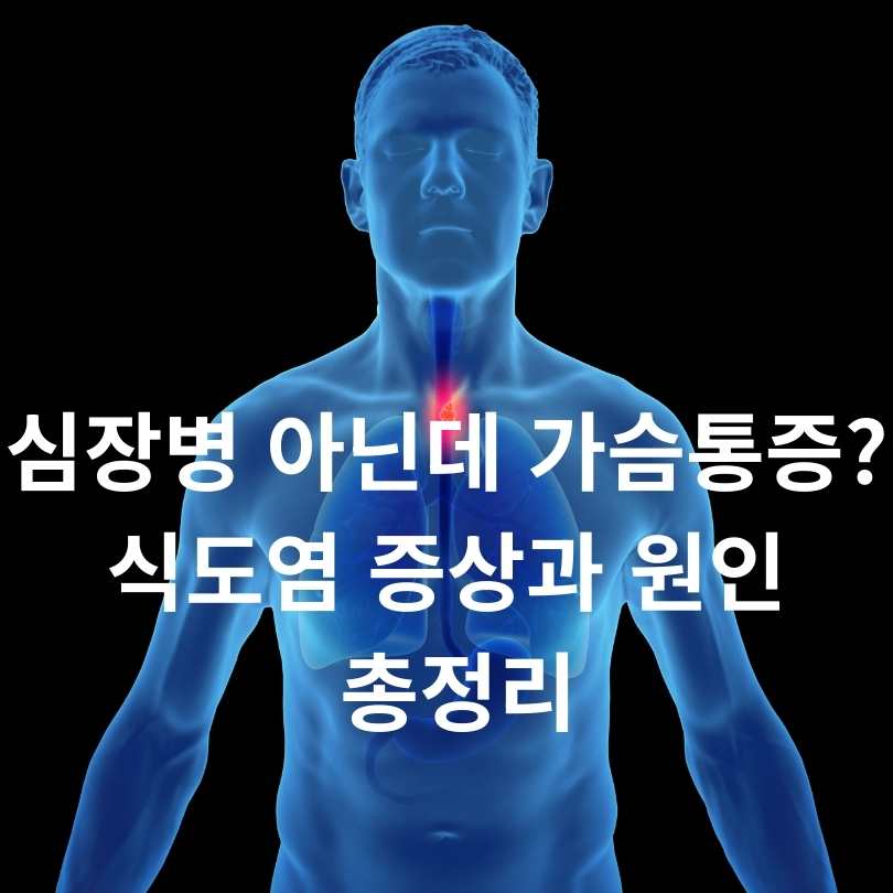 심장병 아닌데 가슴통증? 식도염 증상과 원인 총정리