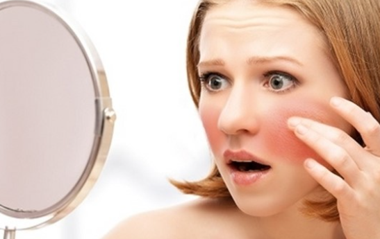 안면홍조증의 원인