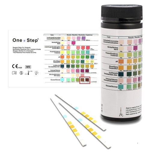 소변 침사 검사 (Urine Sediment Test)