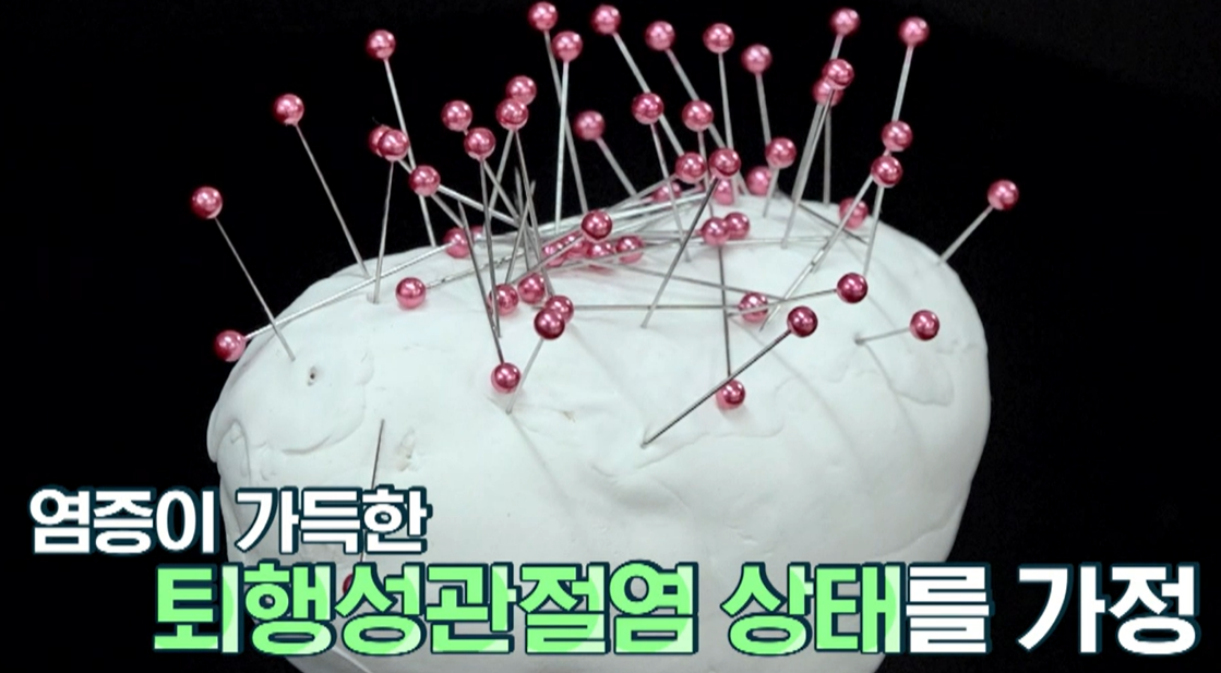 보스웰리아 효능