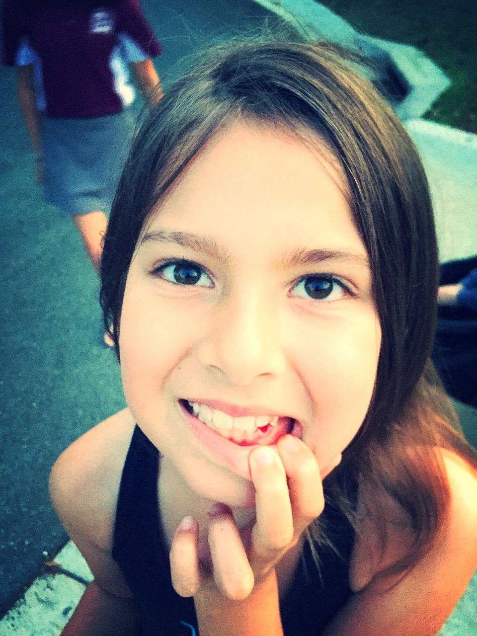 아이의 치아 사진