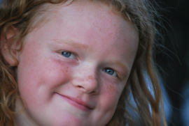 인디언보조개의 관상학적 의미와 수술 방법