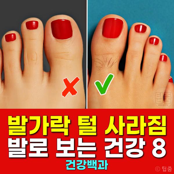 발이 보내는 위험한 신호 발가락 털