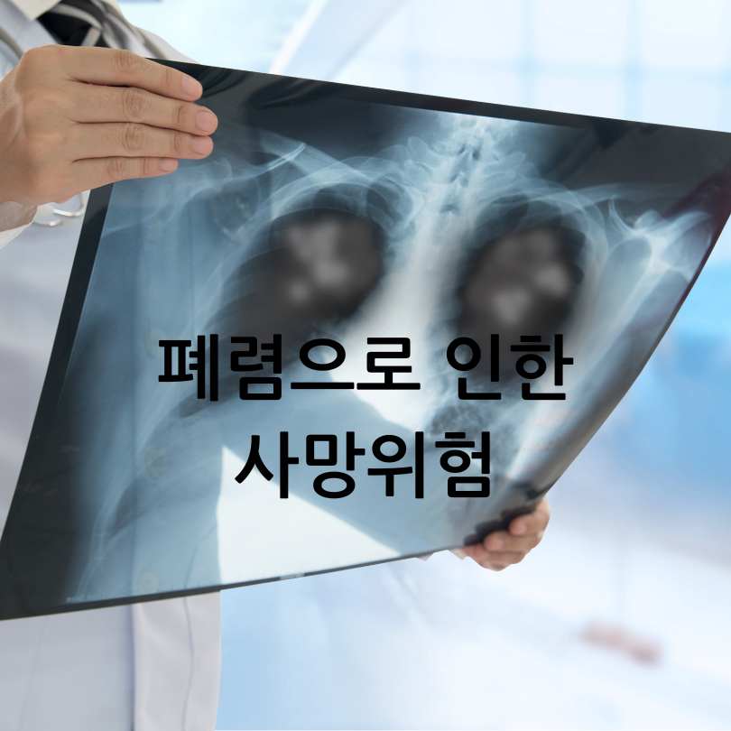 독감과폐렴