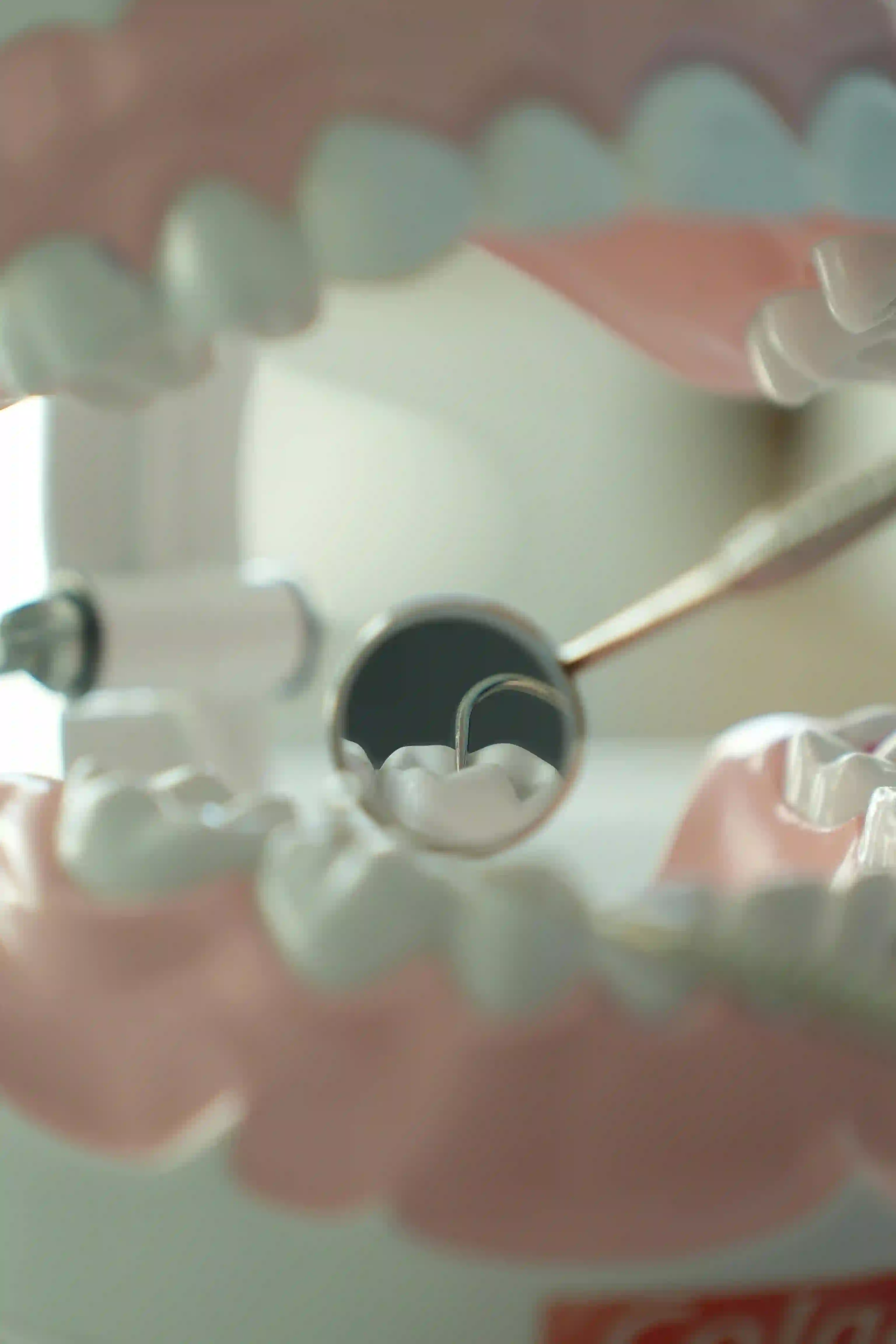 아이 충치 예방을 위한 구강관리법