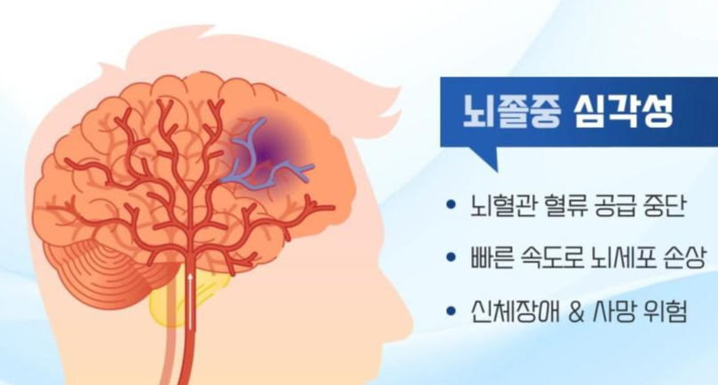 뇌졸중 전조증상과 체크리스트 및 예방과 치료
