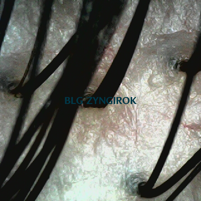 탈모 극복 프로젝트 - 뒷머리 두피 모습이다.