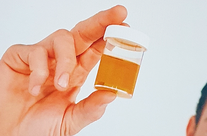 담도암 생존율과 병기별 예후