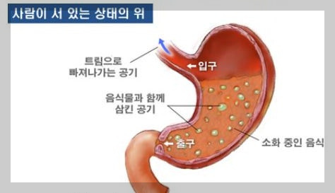 트름이유