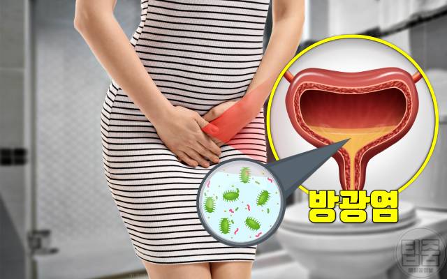 뇌경색 여름철 질병 여름질병 요로감염 방광염