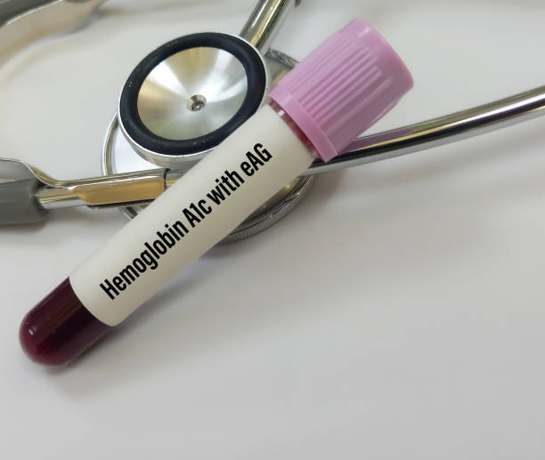 당화혈색소 정상수치 낮추는 방법