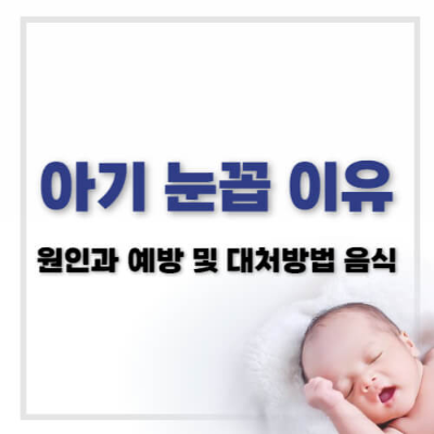 아기 눈꼽, 아기 눈꼽 원인, 아기 눈꼽 대처법, 아기 눈꼽 증상, 아기 결막염, 아기 안구 건강, 아기 눈꼽 제거법, 아기 눈꼽 예방