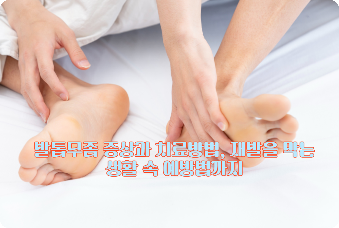 발톱무좀 증상과 치료방법, 재발을 막는 생활 속 예방법까지