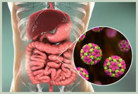 노로바이러스 원인