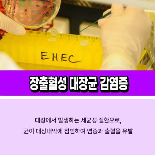 장출혈성_대장균_감염증