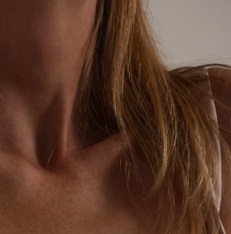 두드러기 치료방법 진단 기준 합병증