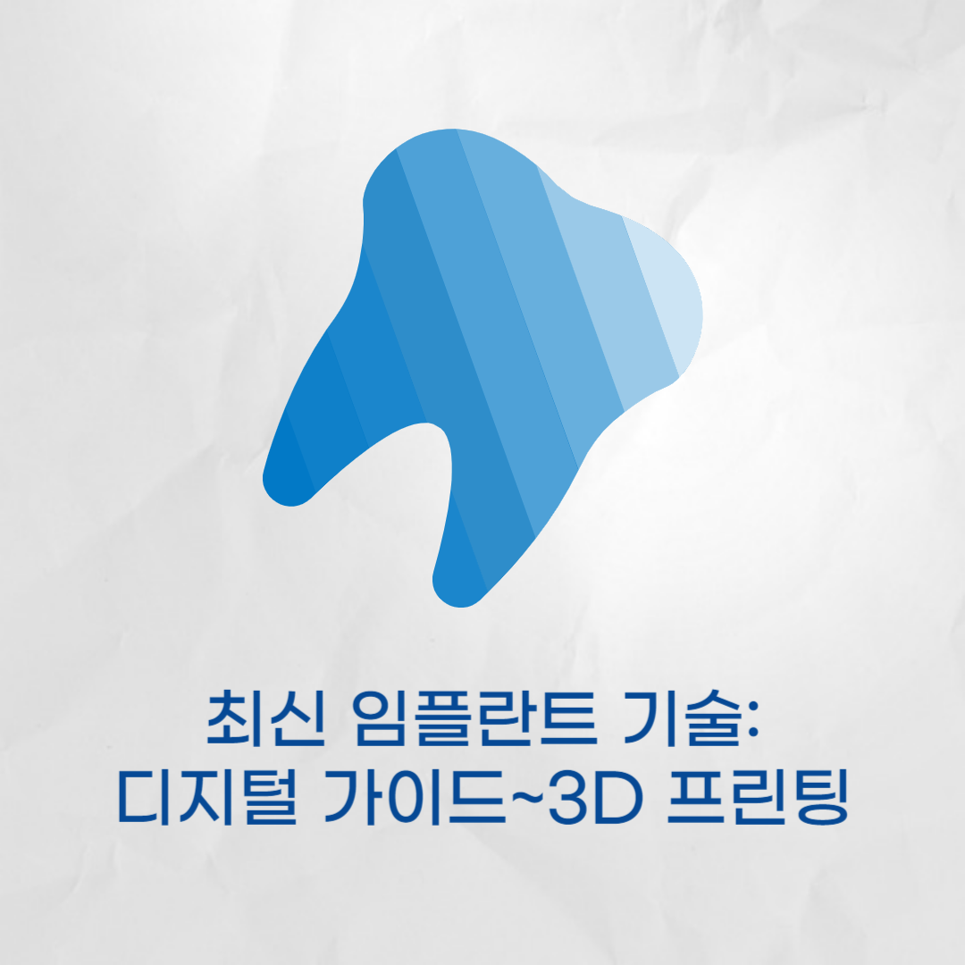 최신 임플란트 기술 - 디지털 가이드에서 3D 프린팅까지(비용 효율성 분석)