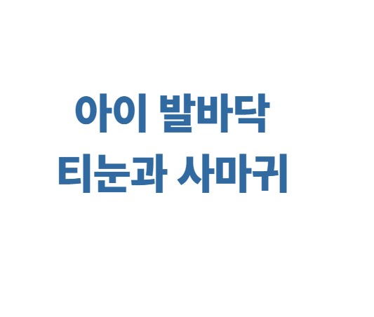 아이 발바닥 티눈과 사마귀