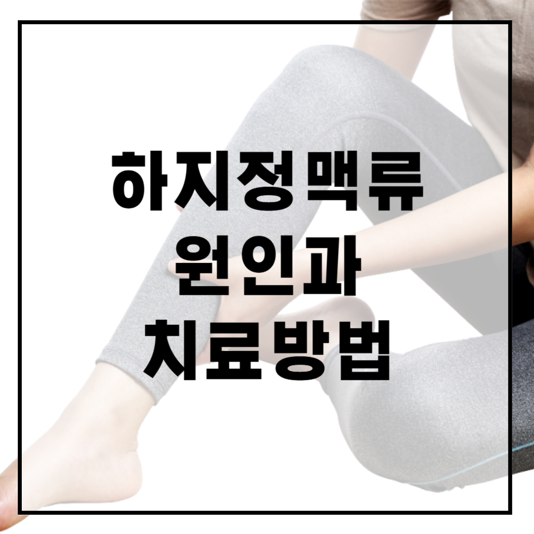 하지정맥류-원인-치료방법