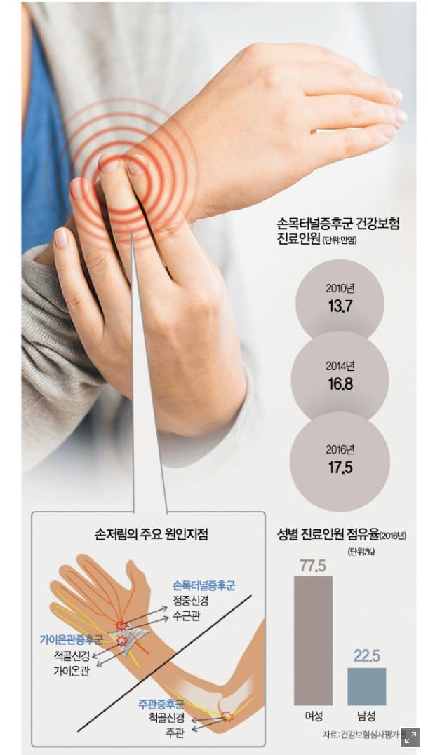 손목 통증&amp;#44; 손목 통증 원인&amp;#44; 손목 통증 치료방법&amp;#44; 손목 통증 병원&amp;#44; 손목 통증 완화운동&amp;#44; 손목 통증 약&amp;#44; 손목 손가락 통증&amp;#44; 손목 짚을때 통증&amp;#44; 손목 손등 통증&amp;#44; 테니스 손목 통증&amp;#44; 손목 통증 스트레칭&amp;#44; 손목 결절종 통증&amp;#44; 손목 터널 증후군&amp;#44; 손목 건초염&amp;#44; 손