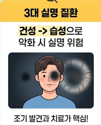 황반변성 치료법
