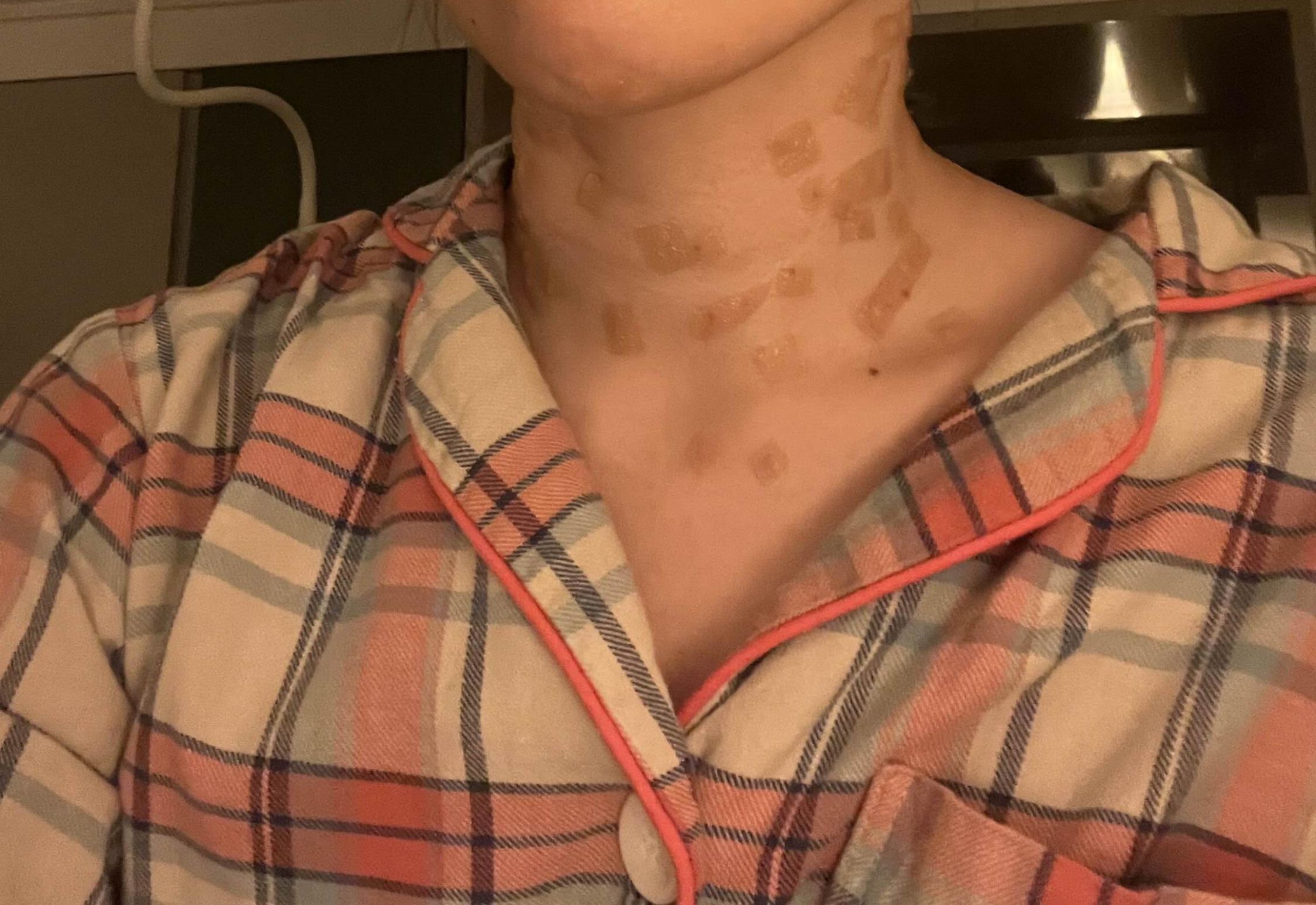 편평사마귀 목 테이핑하기