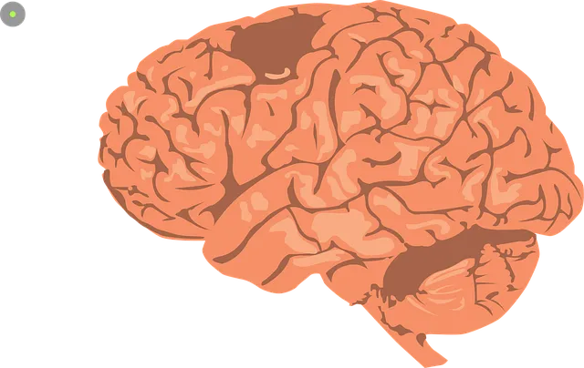 뇌경색 전조증상