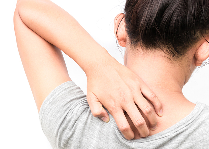 대상포진으로 인한 가려움으로 등을 긁고있다