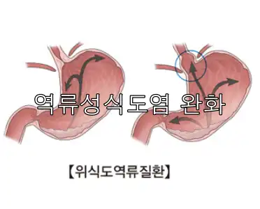 매스틱 효능