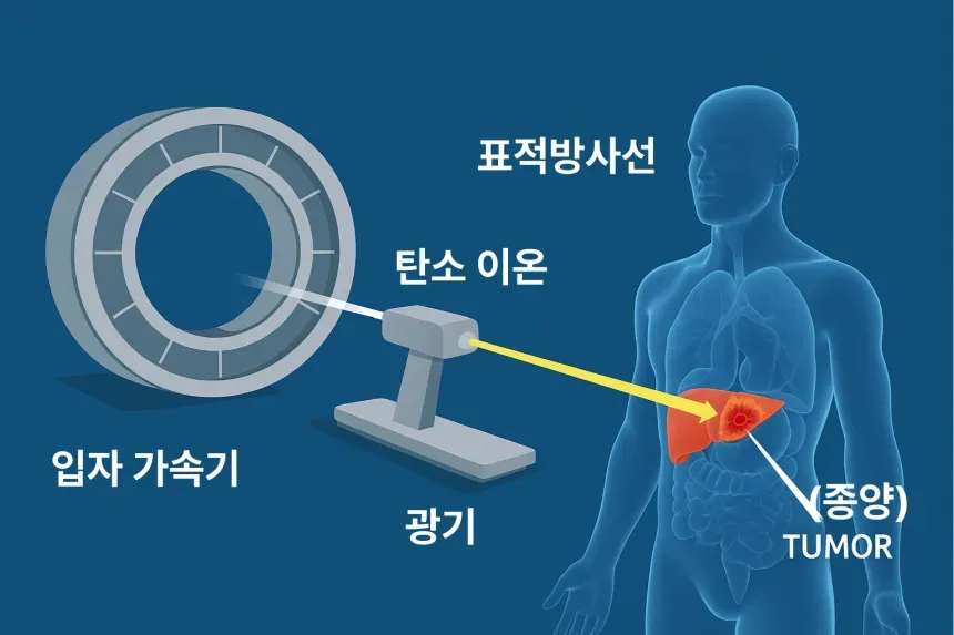 중입자 암치료