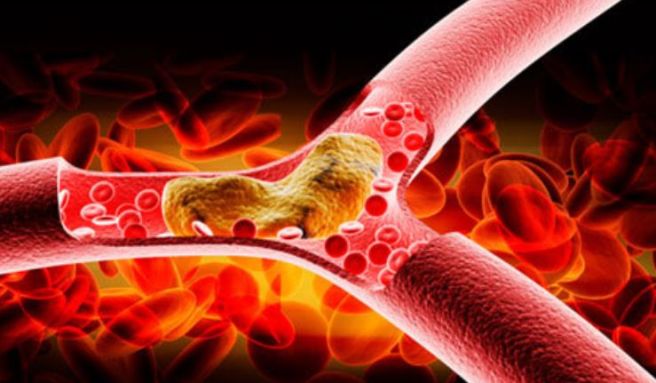 혈관청소에 좋은 음식