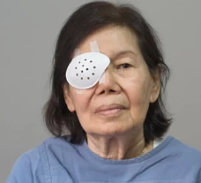 백내장 수술 후 시력회복 기간 주의사항 정리