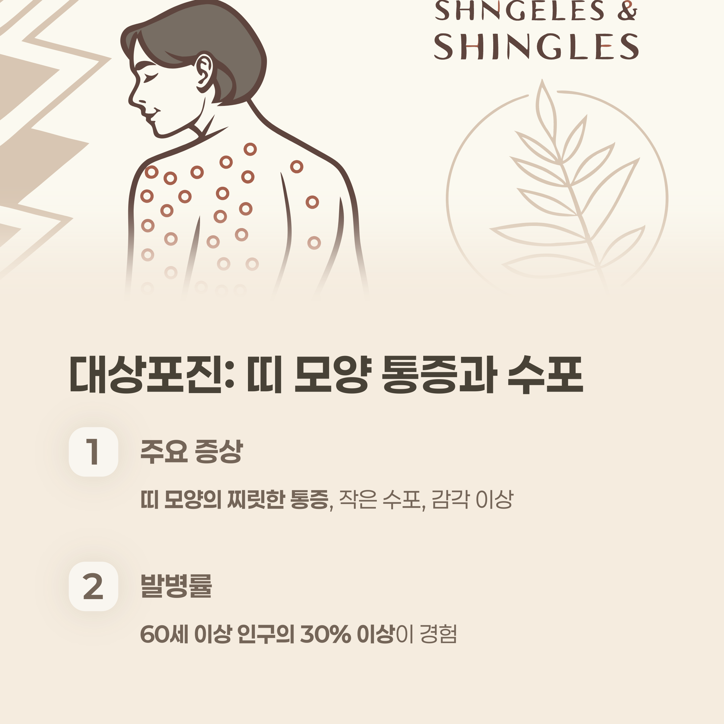 대상포진: 띠 모양 통증과 수포가 보인다면