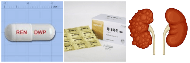 레나메진캡슐, 신부전증 사진