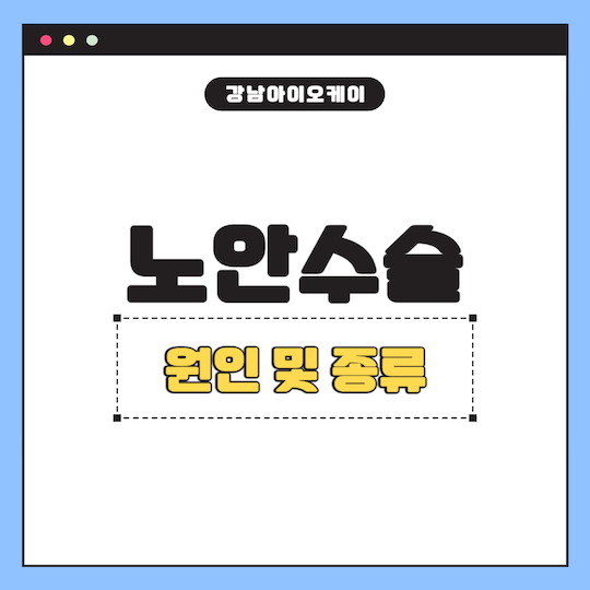 노안수술-원인-종류