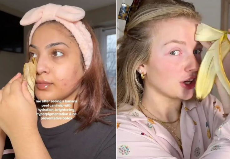 바나나껍질 보톡스