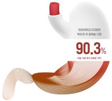 위암 초기증상
